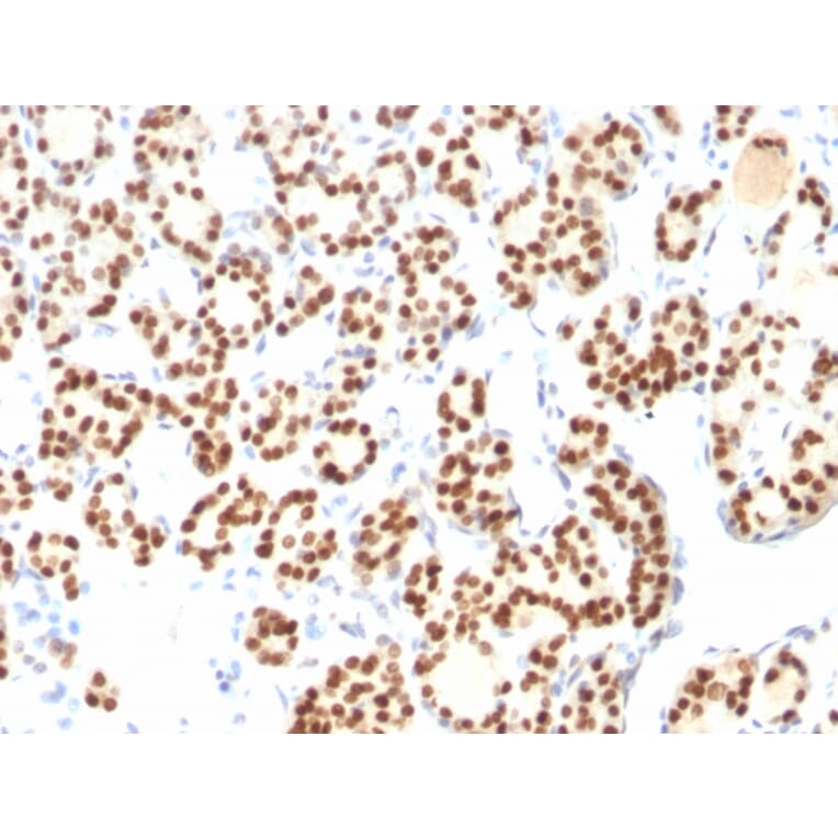 Immunohistochemistry - Anti-TTF1 Antibody [8G7G3/1 + NX2.1/690] (A250142) - Antibodies.com