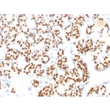 Immunohistochemistry - Anti-TTF1 Antibody [8G7G3/1 + NX2.1/690] (A250142) - Antibodies.com