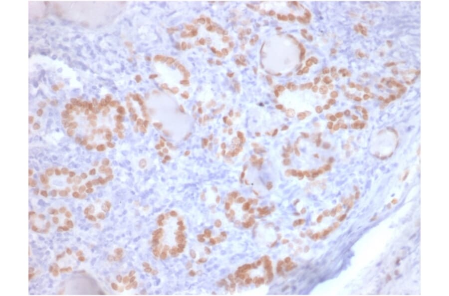 Immunohistochemistry - Anti-TTF1 Antibody [rNX2.1/690] (A250142) - Antibodies.com
