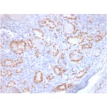 Immunohistochemistry - Anti-TTF1 Antibody [rNX2.1/690] (A250142) - Antibodies.com