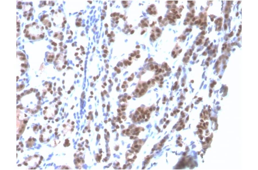 Immunohistochemistry - Anti-TTF1 Antibody [rNX2.1/690] (A250143) - Antibodies.com