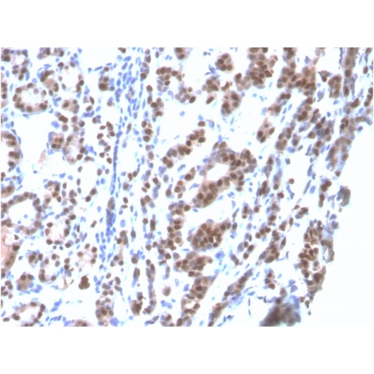 Immunohistochemistry - Anti-TTF1 Antibody [rNX2.1/690] (A250143) - Antibodies.com