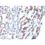 Immunohistochemistry - Anti-TTF1 Antibody [rNX2.1/690] (A250143) - Antibodies.com