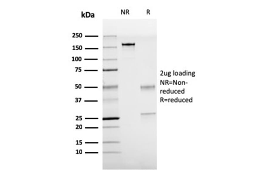 SDS-PAGE - Anti-TTF1 Antibody [rNX2.1/690] (A250143) - Antibodies.com
