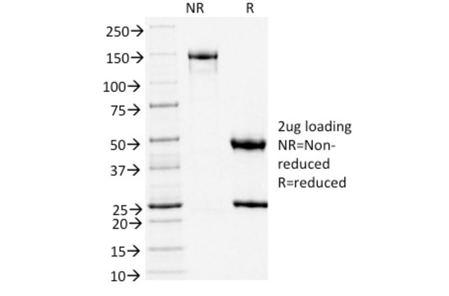 SDS-PAGE - Anti-TLE1 Antibody [TLE1/2051] (A250145) - Antibodies.com