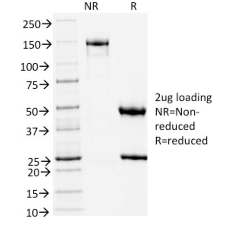 SDS-PAGE - Anti-TLE1 Antibody [TLE1/2051] (A250145) - Antibodies.com