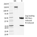 SDS-PAGE - Anti-TLE1 Antibody [TLE1/2051] (A250145) - Antibodies.com