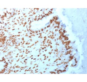 Immunohistochemistry - Anti-TLE1 Antibody [TLE1/2062] (A250146) - Antibodies.com