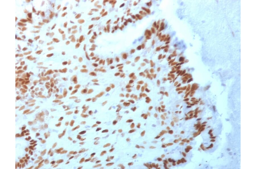 Immunohistochemistry - Anti-TLE1 Antibody [TLE1/2062] (A250146) - Antibodies.com
