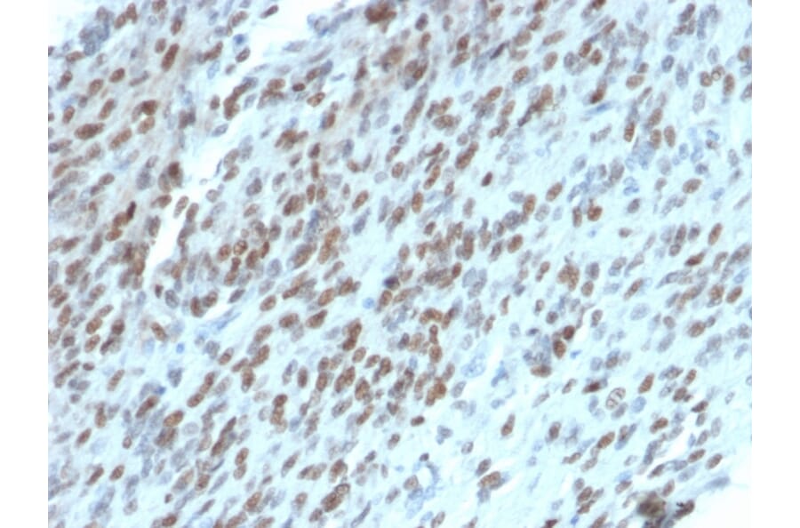 Immunohistochemistry - Anti-TLE1 Antibody [TLE1/2062] (A250146) - Antibodies.com