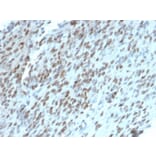Immunohistochemistry - Anti-TLE1 Antibody [TLE1/2062] (A250146) - Antibodies.com