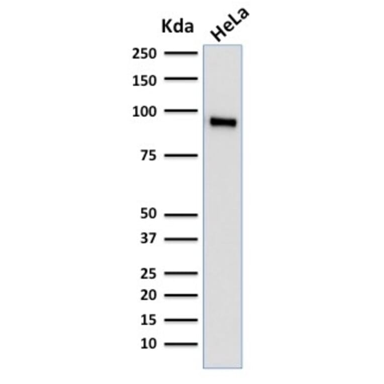 Western Blot - Anti-TLE1 Antibody [TLE1/2062] (A250146) - Antibodies.com