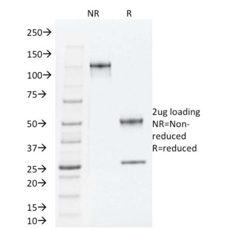 SDS-PAGE - Anti-TLE1 Antibody [TLE1/2062] (A250146) - Antibodies.com
