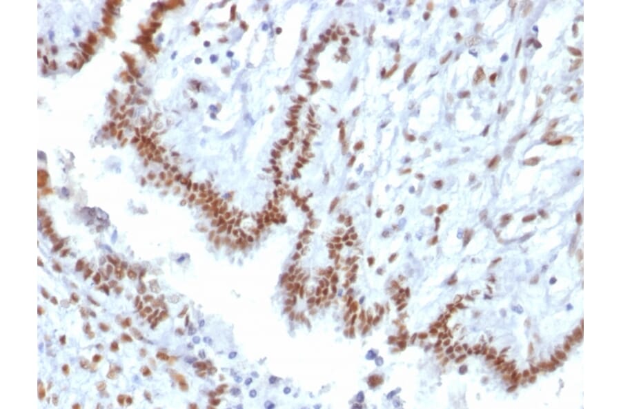 Immunohistochemistry - Anti-TLE1 Antibody [TLE1/2085] (A250147) - Antibodies.com