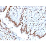 Immunohistochemistry - Anti-TLE1 Antibody [TLE1/2085] (A250147) - Antibodies.com