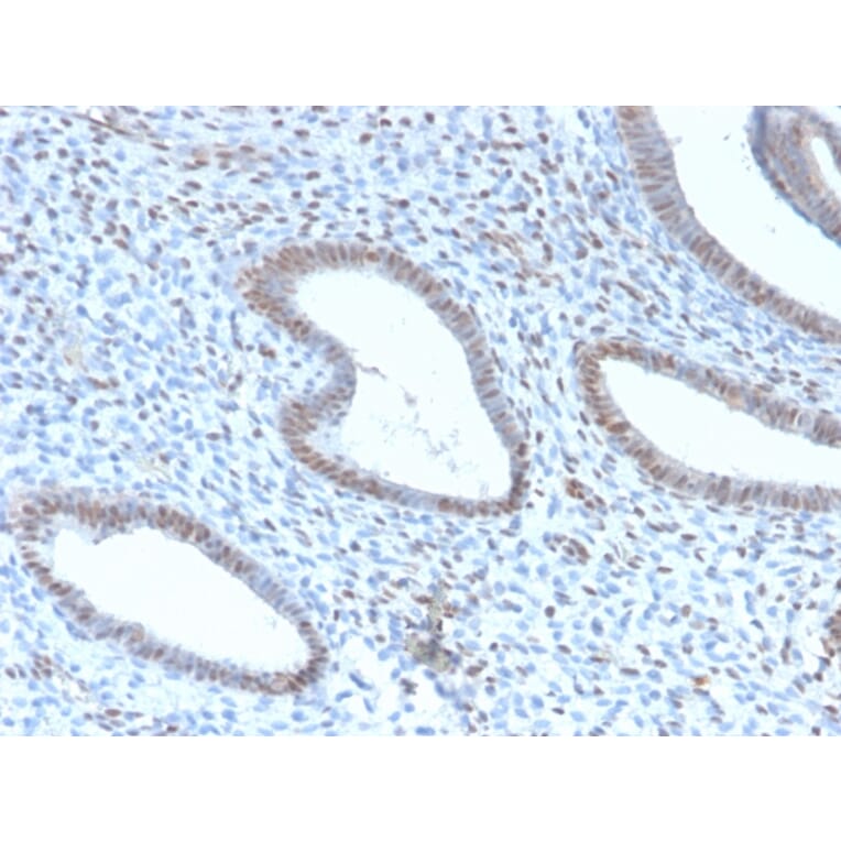 Immunohistochemistry - Anti-TLE1 Antibody [TLE1/2946R] (A250147) - Antibodies.com