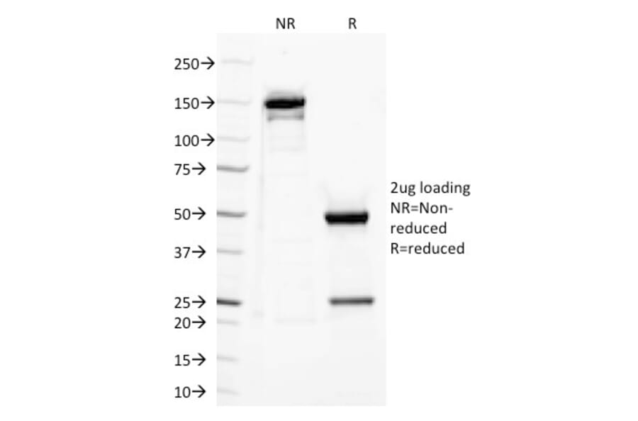 SDS-PAGE - Anti-TLR2 Antibody [TLR2/221] (A250148) - Antibodies.com