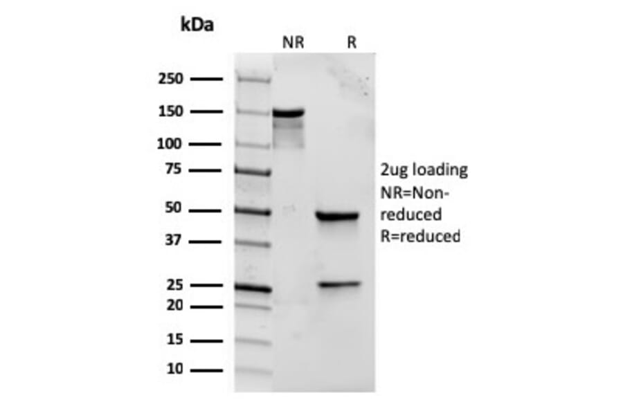 SDS-PAGE - Anti-TLR2 Antibody [rTLR2/221] (A250149) - Antibodies.com