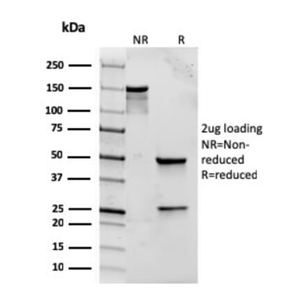 SDS-PAGE - Anti-TLR2 Antibody [rTLR2/221] (A250149) - Antibodies.com