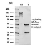SDS-PAGE - Anti-TLR2 Antibody [rTLR2/221] (A250149) - Antibodies.com