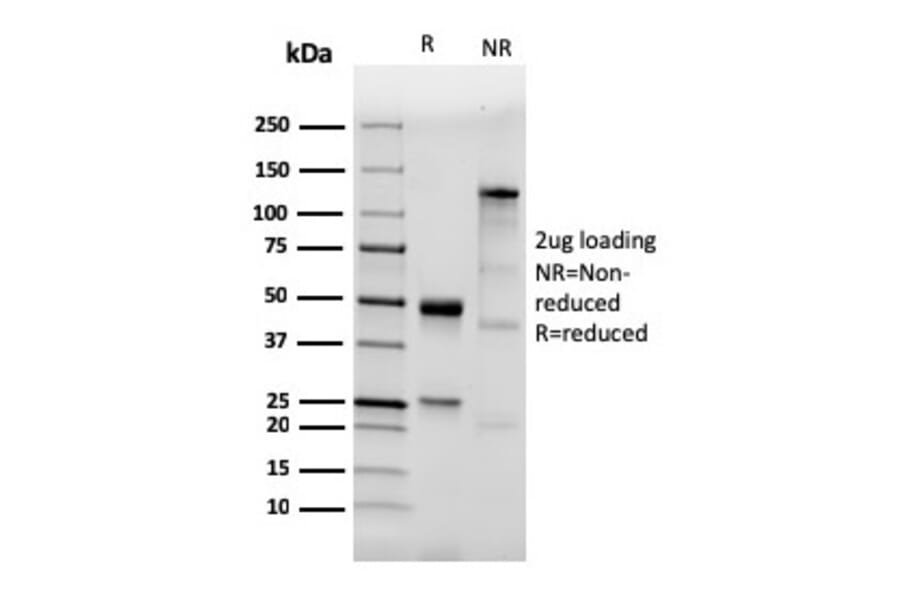 SDS-PAGE - Anti-TLR2 Antibody [TLR2/3894R] (A250150) - Antibodies.com