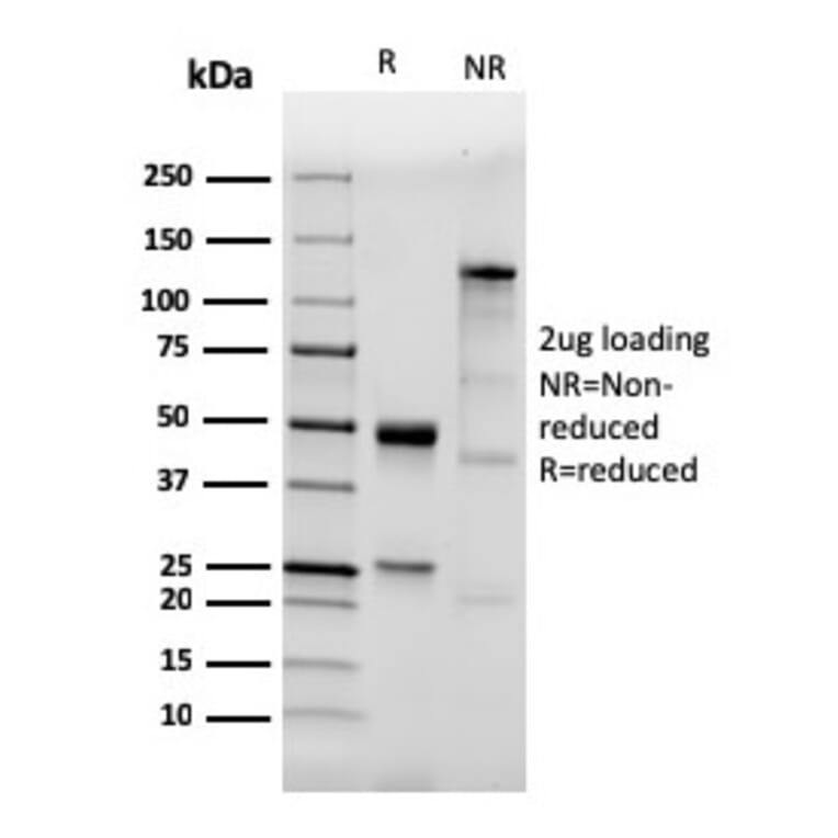 SDS-PAGE - Anti-TLR2 Antibody [TLR2/3894R] (A250150) - Antibodies.com