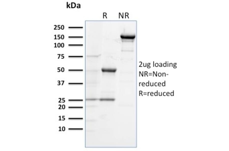 SDS-PAGE - Anti-TLR4 Antibody [TLR4/230] (A250151) - Antibodies.com