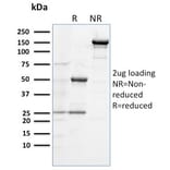 SDS-PAGE - Anti-TLR4 Antibody [TLR4/230] (A250151) - Antibodies.com