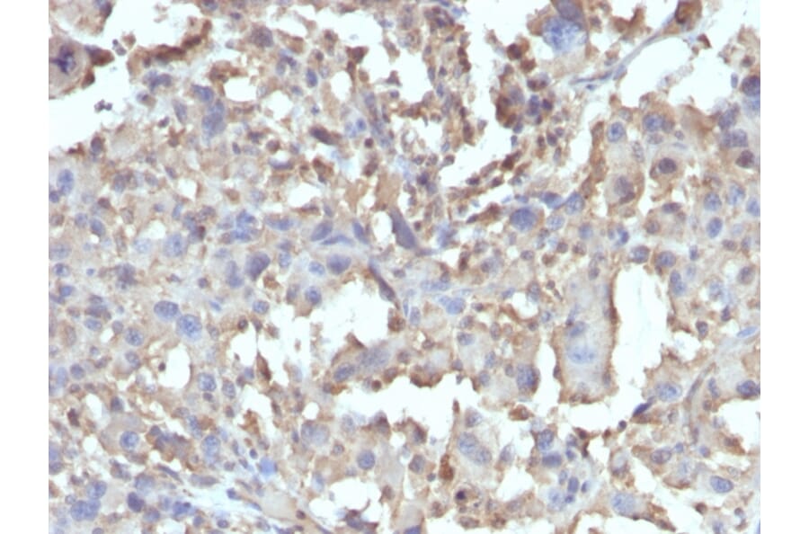 Immunohistochemistry - Anti-TNF alpha Antibody [TNF/1500R] (A250155) - Antibodies.com