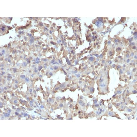Immunohistochemistry - Anti-TNF alpha Antibody [TNF/1500R] (A250155) - Antibodies.com
