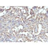 Immunohistochemistry - Anti-TNF alpha Antibody [TNF/1500R] (A250155) - Antibodies.com