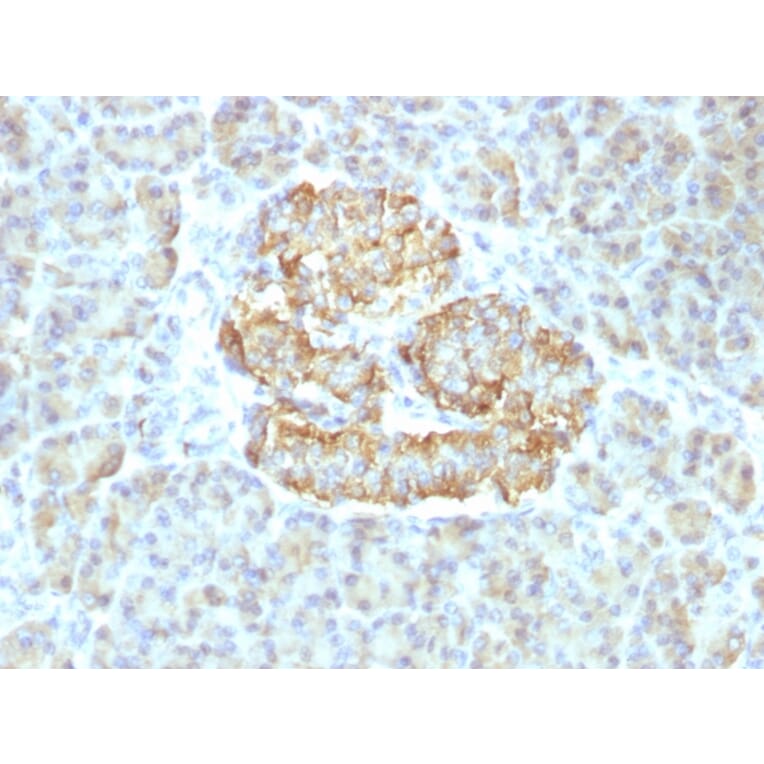 Immunohistochemistry - Anti-TNF alpha Antibody [TNF/1500R] (A250156) - Antibodies.com