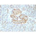 Immunohistochemistry - Anti-TNF alpha Antibody [TNF/1500R] (A250156) - Antibodies.com