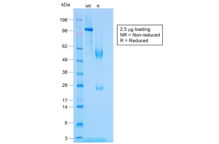 SDS-PAGE - Anti-TNF alpha Antibody [TNF/1500R] (A250156) - Antibodies.com