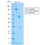 SDS-PAGE - Anti-TNF alpha Antibody [TNF/1500R] (A250156) - Antibodies.com