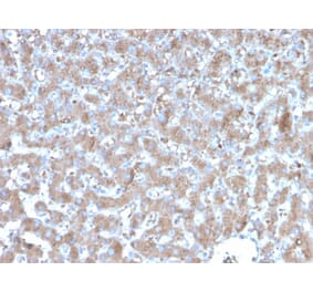 Immunohistochemistry - Anti-TNFAIP3 Antibody [TNFAIP3/2813] (A250158) - Antibodies.com