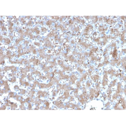 Immunohistochemistry - Anti-TNFAIP3 Antibody [TNFAIP3/2813] (A250158) - Antibodies.com