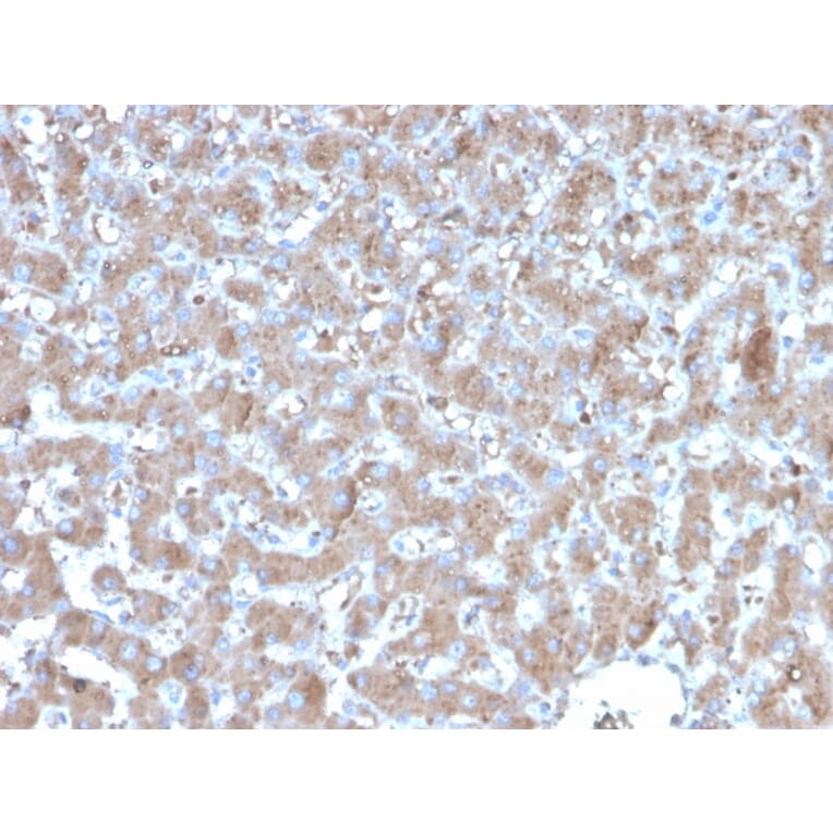Immunohistochemistry - Anti-TNFAIP3 Antibody [TNFAIP3/2813] (A250158) - Antibodies.com