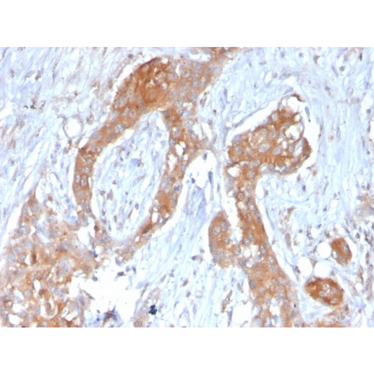 Immunohistochemistry - Anti-TNFAIP3 Antibody [TNFAIP3/2813] (A250157) - Antibodies.com