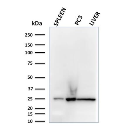 Western Blot - Anti-C1QA Antibody [C1QA/2783] (A250159) - Antibodies.com