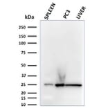 Western Blot - Anti-C1QA Antibody [C1QA/2783] (A250159) - Antibodies.com