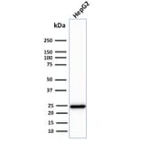 Western Blot - Anti-C1QA Antibody [C1QA/2783] (A250159) - Antibodies.com