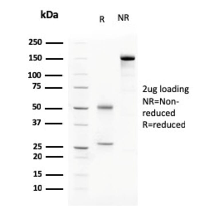 SDS-PAGE - Anti-C1QA Antibody [C1QA/2783] (A250159) - Antibodies.com