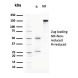 SDS-PAGE - Anti-C1QA Antibody [C1QA/2783] (A250159) - Antibodies.com