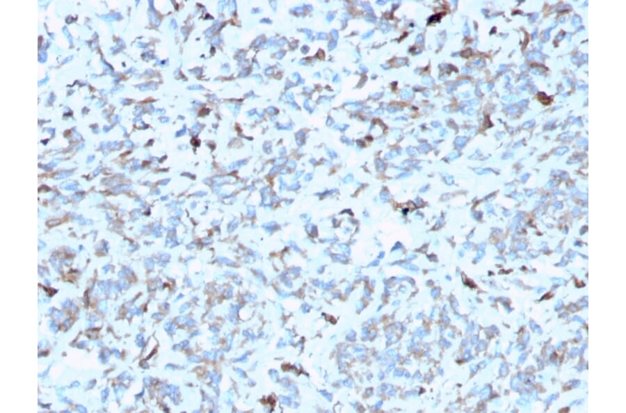Immunohistochemistry - Anti-C1QA Antibody [C1QA/2952] (A250160) - Antibodies.com