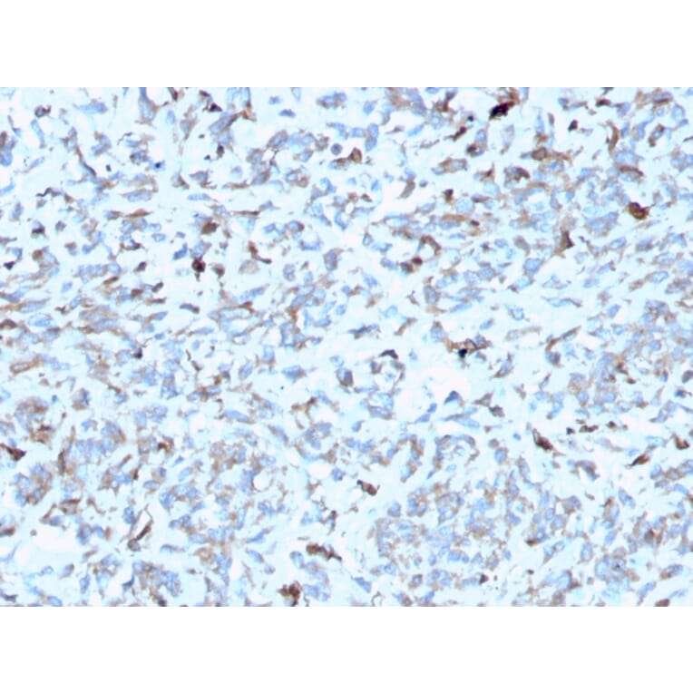 Immunohistochemistry - Anti-C1QA Antibody [C1QA/2952] (A250160) - Antibodies.com