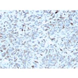 Immunohistochemistry - Anti-C1QA Antibody [C1QA/2952] (A250160) - Antibodies.com