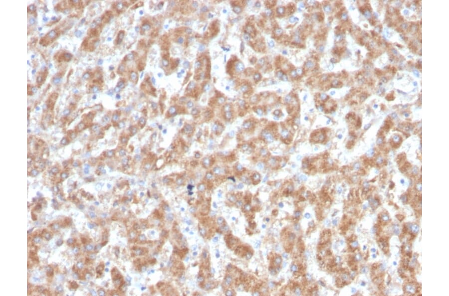 Immunohistochemistry - Anti-C1QA Antibody [C1QA/2952] (A250160) - Antibodies.com