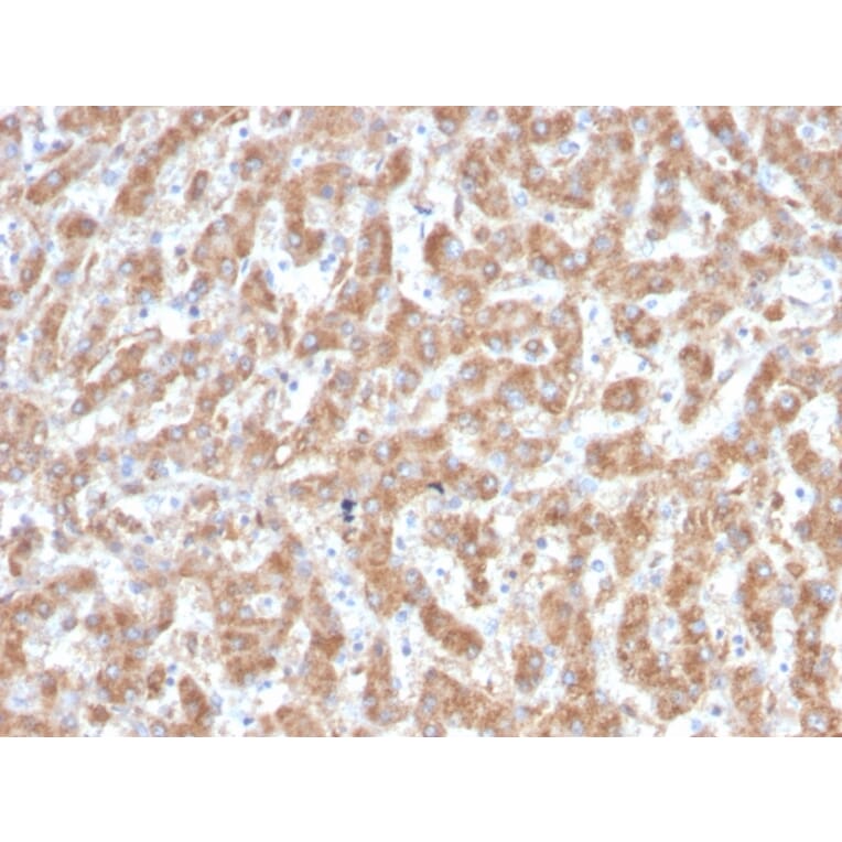 Immunohistochemistry - Anti-C1QA Antibody [C1QA/2952] (A250160) - Antibodies.com