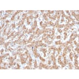 Immunohistochemistry - Anti-C1QA Antibody [C1QA/2952] (A250160) - Antibodies.com